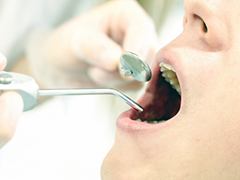 虫歯と歯周病の治療